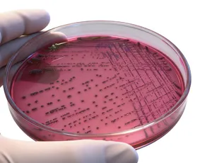Química Sanguínea 27 Elementos